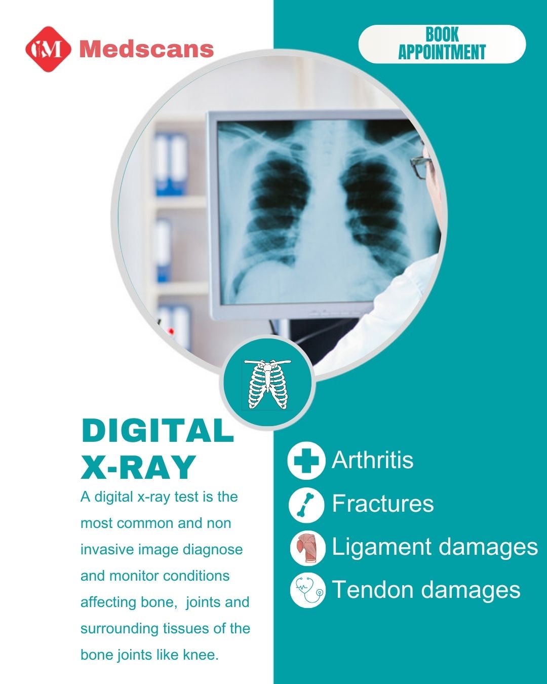Digital X -Ray