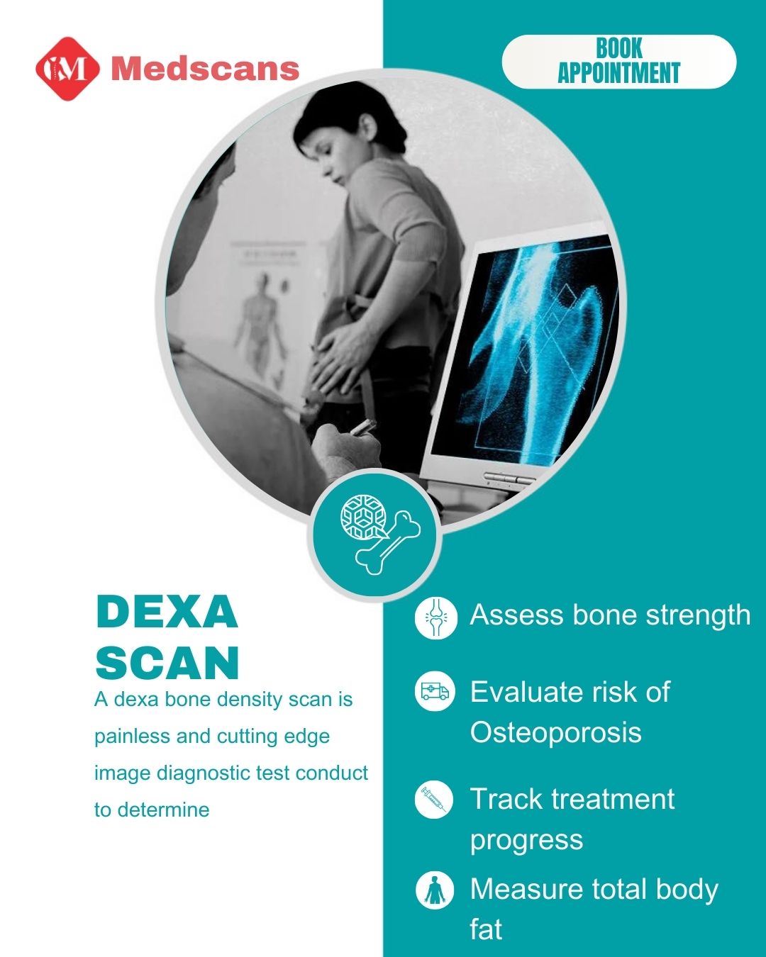 DEXA scan
