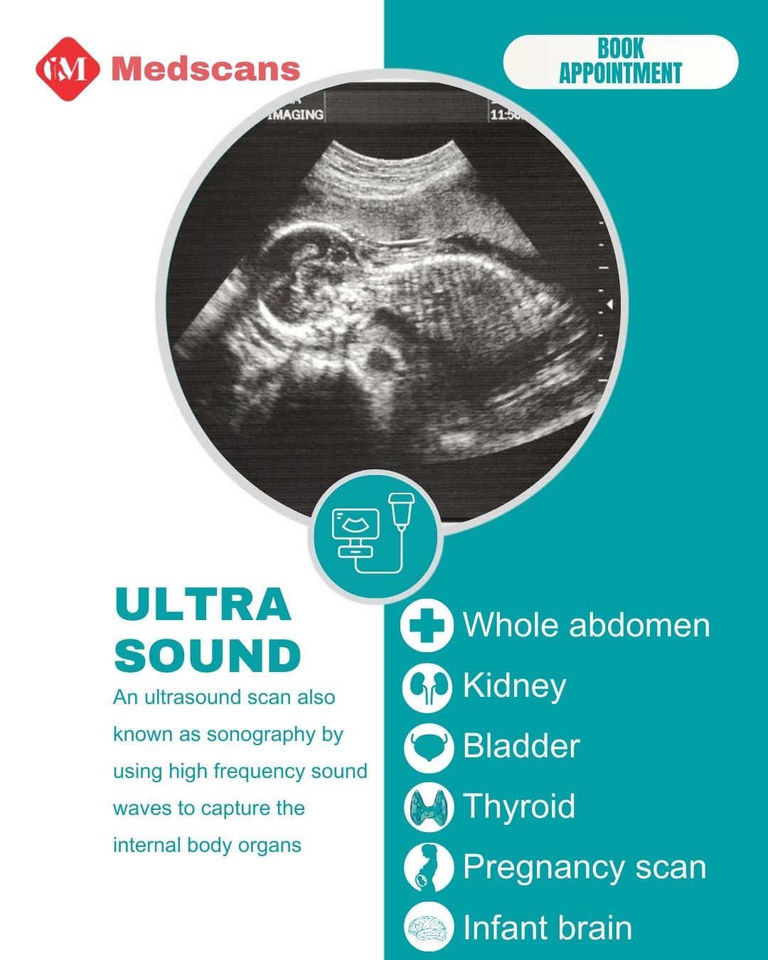 Ultra Sound 