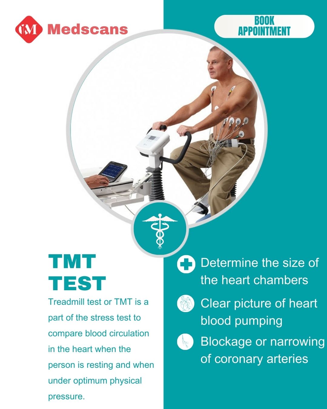 Treadmill test